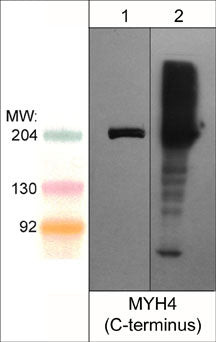 Western blot MYH4 in mouse C2C12 and extraocular muscle using antibody STJA0041276