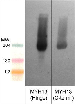 Western blot WB MYH13 in mouse extraocular muscle using antibody STJA0041278