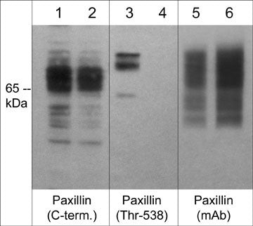 Western blot A431 cells phospho-Paxillin Thr-538 detection using antibody STJA0041353
