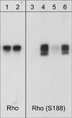 Western blot analysis RhoA phosphorylation using anti-RhoA Ser-188 antibody STJA0041362