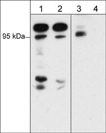 Western blot B-Raf phosphorylation in Jurkat cells with phosphatase treatment comparison STJA0041363