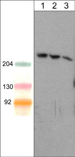 anti-Shank1 antibody WB analysis mouse brain lysate at multiple dilutions STJA0041383