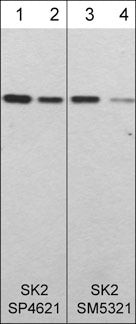 Western blot human recombinant SK2 detection using antibody at various dilutions STJA0041386