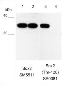 Sox2 phospho-specific antibody WB treated and untreated mouse F9 stem cells STJA0041390