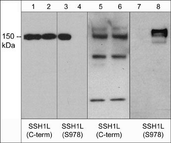 Western blot SSH1L protein in human recombinant and rat PC12 cell lysates STJA0041400