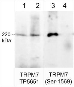 Western blot rat PC12 cells TRPM7 detection using rabbit polyclonal antibody STJA0041430