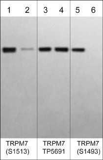 Western blot TRPM7 C-terminal kinase domain probed with antibody phosphorylation specificity STJA0041434