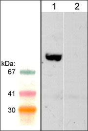 anti-WAVE2 antibody WB analysis rat PC12 lysate with blocking peptide control STJA0041449