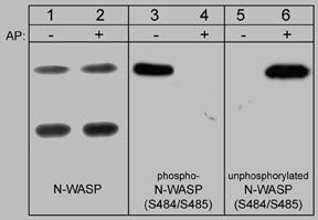 Western blot N-WASP phosphorylated and unphosphorylated forms in rat brain lysate STJA0041451
