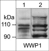 Western blot WWP1 expression in mouse liver and PC3 cells using antibody STJA0041456