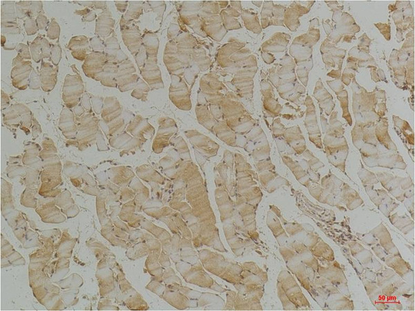 Desmin antibody immunohistochemistry mouse skeletal muscle STJA0032972
