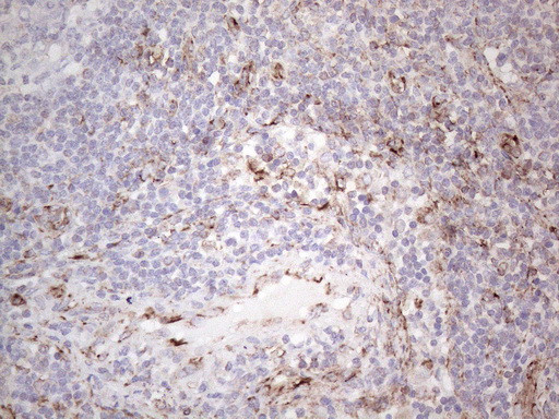 PRPH antibody immunohistochemistry human lymph node STJA0033371
