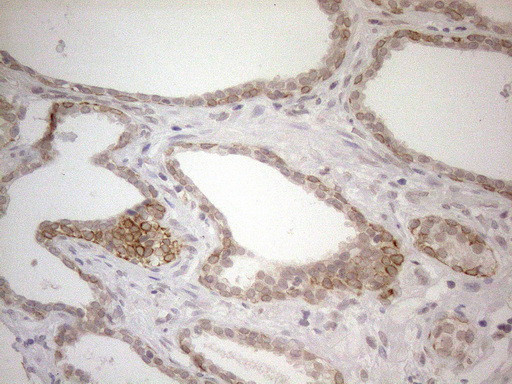 PD-L2 antibody immunohistochemistry human prostate tissue STJA0033387