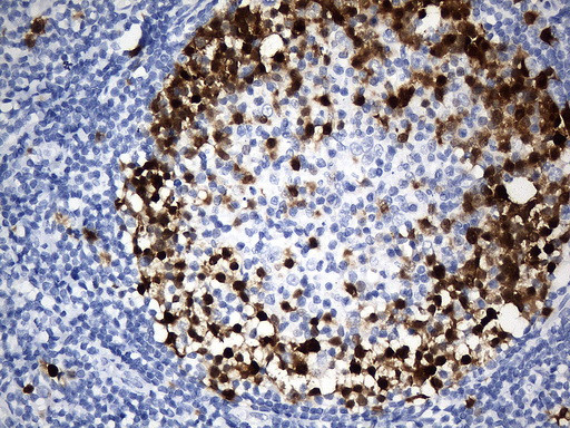 Thymidylate Synthase antibody immunohistochemistry human lymph node STJA0033389