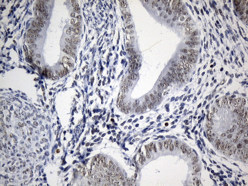 FOXP1 antibody immunohistochemistry human endometrium tissue STJA0033397