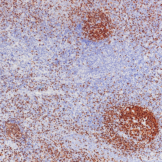 PAX5 antibody immunohistochemistry paraffin-embedded tonsil tissue STJA0033404