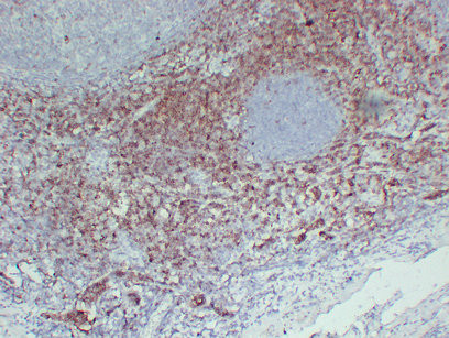 CD7 antibody immunohistochemistry tonsil tissue paraffin-embedded STJA0033432