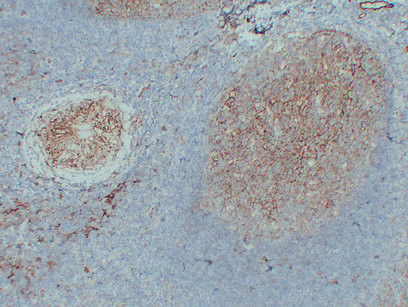 ICAM1 antibody immunohistochemistry paraffin-embedded tonsil tissue STJA0033457