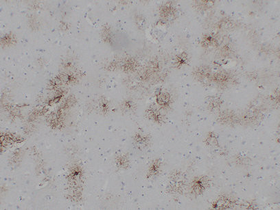 GFAP antibody immunohistochemistry paraffin-embedded brain tissue STJA0033521