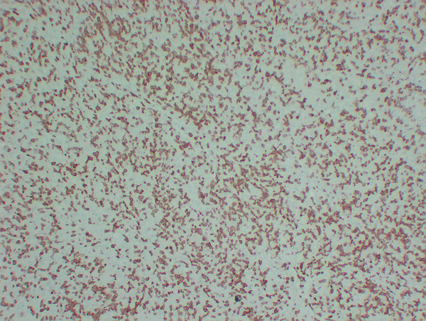 ZAP70 antibody immunohistochemistry human tonsil STJA0033538