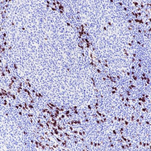 CD8 alpha antibody immunohistochemistry human tonsil STJA0033714
