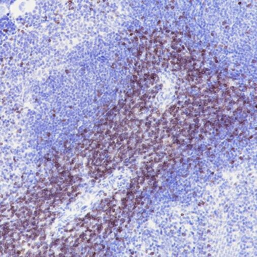CD3 epsilon antibody immunohistochemistry mouse spleen STJA0033715