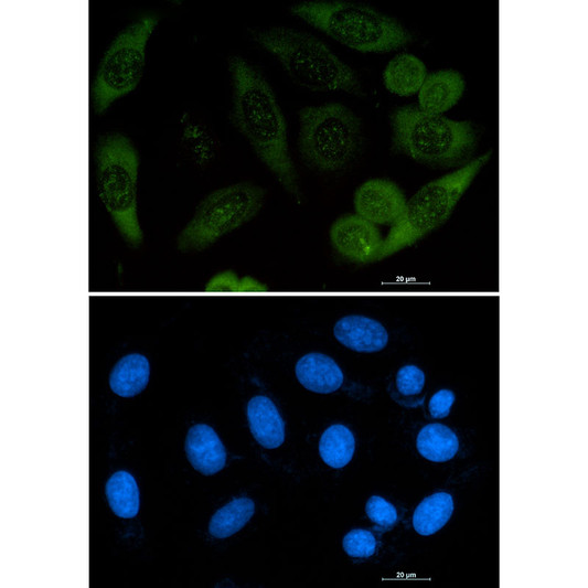 Profilin 1 antibody immunocytochemistry A549 cells DAPI STJA0033866