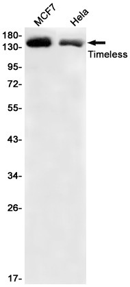 TIMELESS antibody western blot MCF-7 HeLa STJA0034931