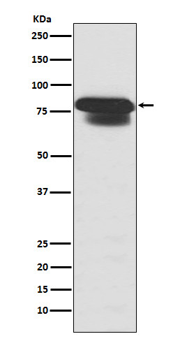 PIAS1/2 antibody western blot HepG2 lysates STJA0036425