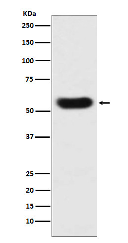 SERPINC1 antibody western blot human plasma STJA0036488