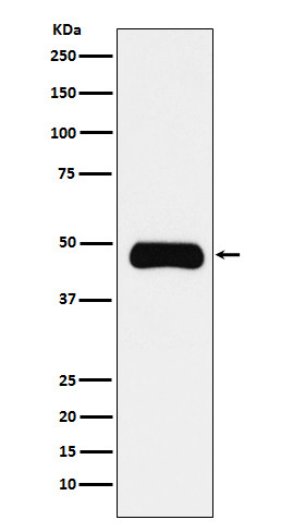 ETS1 antibody western blot Insulin Receptor R Daudi STJA0036563