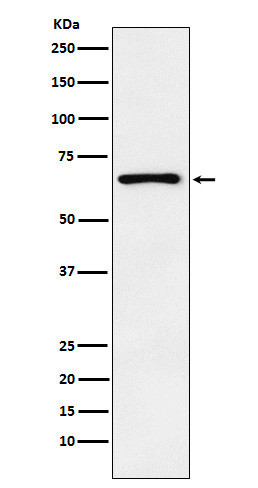Parathyroid Hormone Receptor 1 antibody western blot HeLa STJA0036649