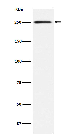 MYH11 antibody western blot human bladder lysates STJA0036741