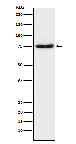 Netrin 1 antibody western blot human fetal brain STJA0036742