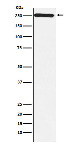 MYO7A antibody western blot Y79 cell lysates STJA0036763