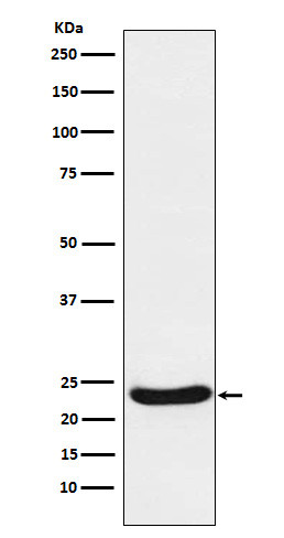 UQCRFS1 antibody western blot Raji lysates STJA0036873