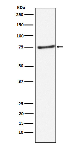 PIAS1 antibody western blot Daudi lysates STJA0036894