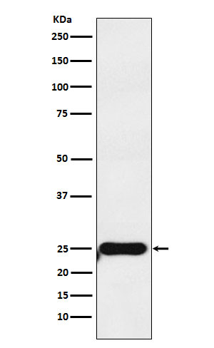 COMT antibody western blot MOLT4 lysates STJA0036967