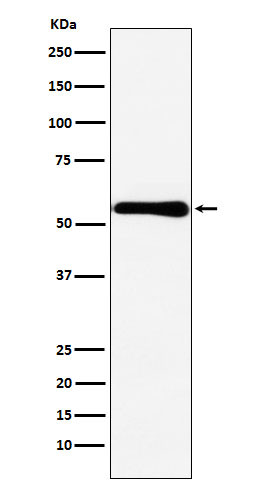 CBS antibody western blot MCF-7 lysates STJA0037010