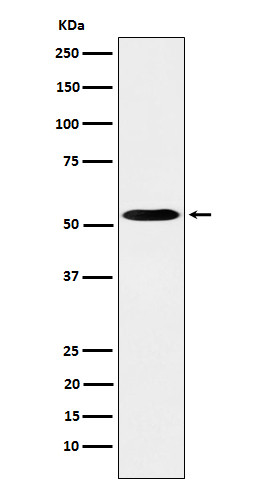 PKA RII alpha antibody western blot K562 STJA0037079