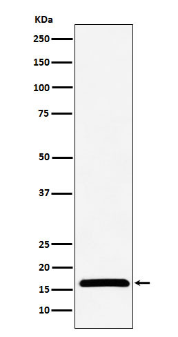 NME2 antibody western blot LnCaP STJA0037438