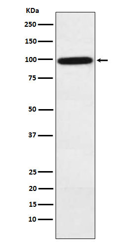 Complement factor B antibody western blot human plasma STJA0037445