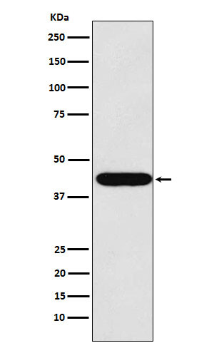 LHX2 antibody western blot HeLa lysates STJA0037446