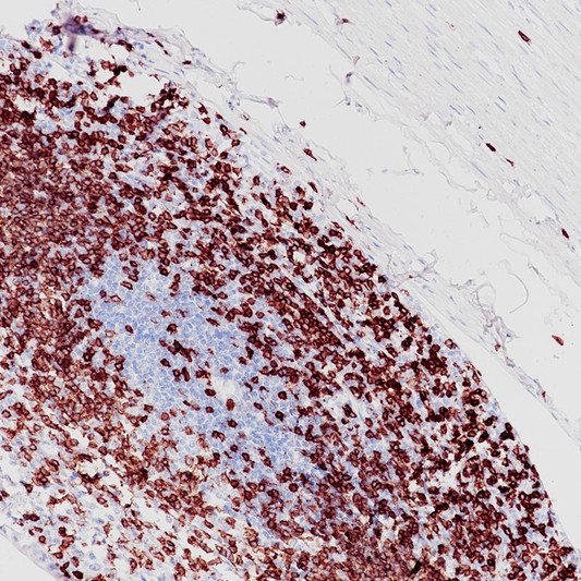 CD3e antibody immunohistochemistry paraffin-embedded appendix STJA0037594