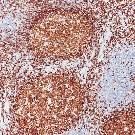 CD79a antibody immunohistochemistry paraffin-embedded tonsil STJA0037604
