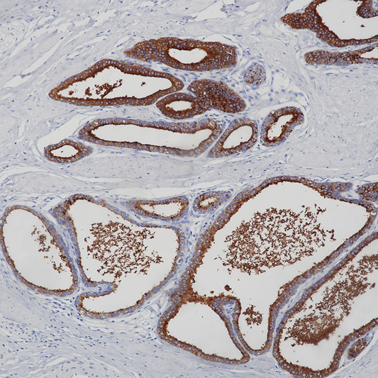 Prostatic Acid Phosphatase antibody immunohistochemistry prostate tissue STJA0037613