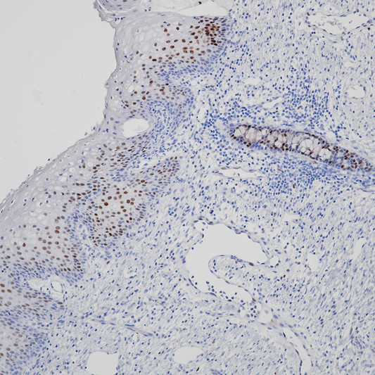 p21 antibody immunohistochemistry cervix paraffin-embedded STJA0037627