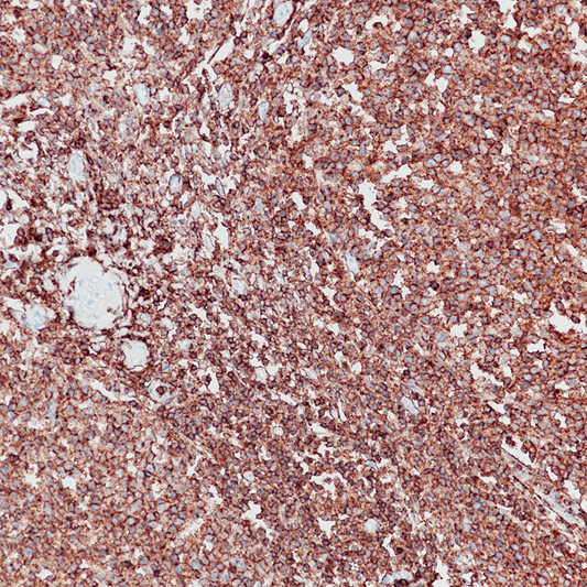 CD45 antibody immunohistochemistry paraffin-embedded tonsil tissue STJA0037630