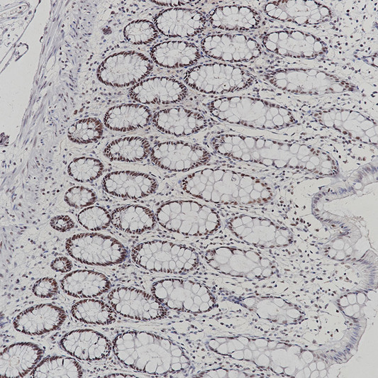 PMS2 antibody immunohistochemistry paraffin-embedded colon tissue STJA0037660