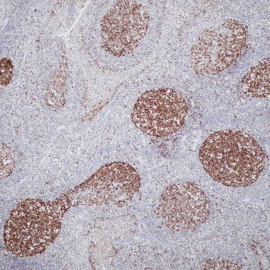 RRM1 antibody immunohistochemistry paraffin-embedded tonsil tissue STJA0037664